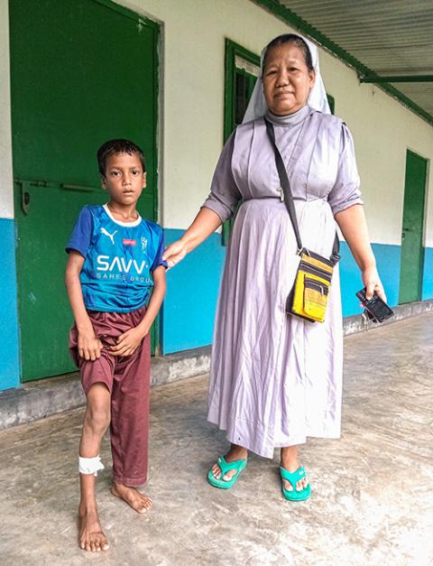 Moaj Islam, 10, shows his snakebite injury as Sr. Baptista Rema accompanies him at Our Lady of Lourdes Hospital in Baromari, Sherpur, Bangladesh. (Sumon Corraya)