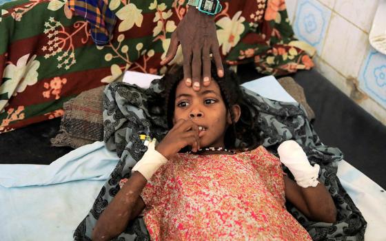 An 8-year-old girl receives treatment at Ethiopia's Dubti Referral Hospital Feb. 24. The girl lost her left hand from explosives left near her house.